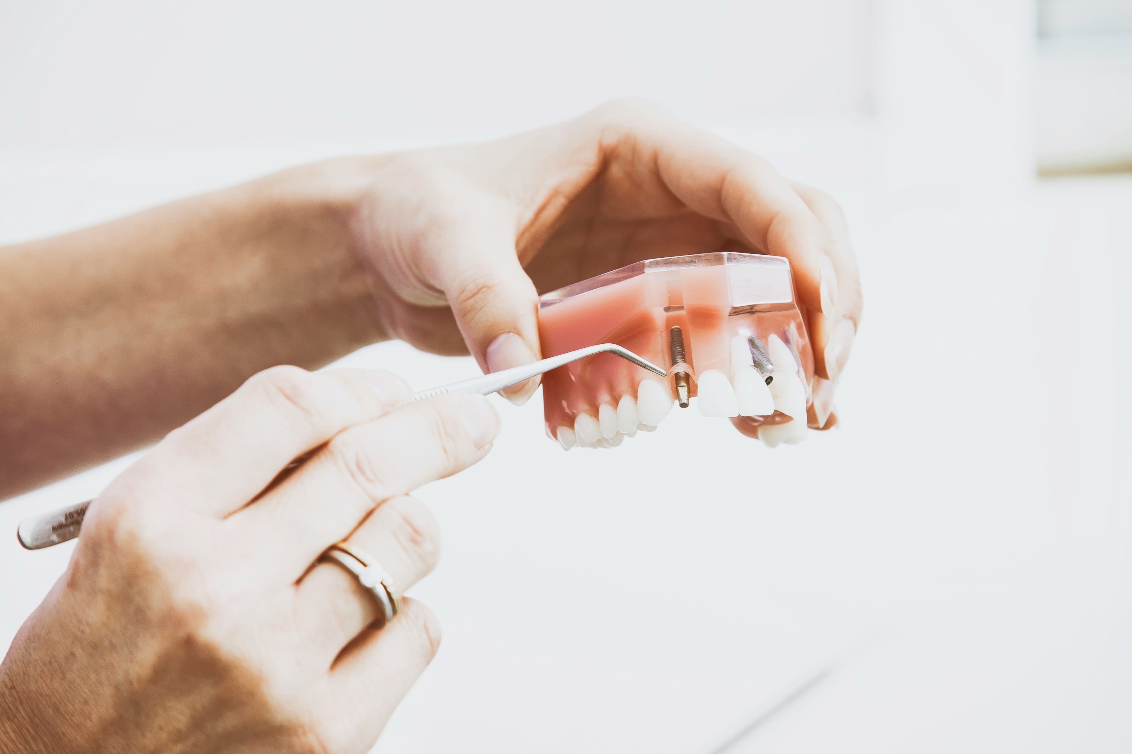 dental implant treatment in Birmingham